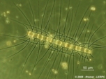 Chaetoceros decipiens